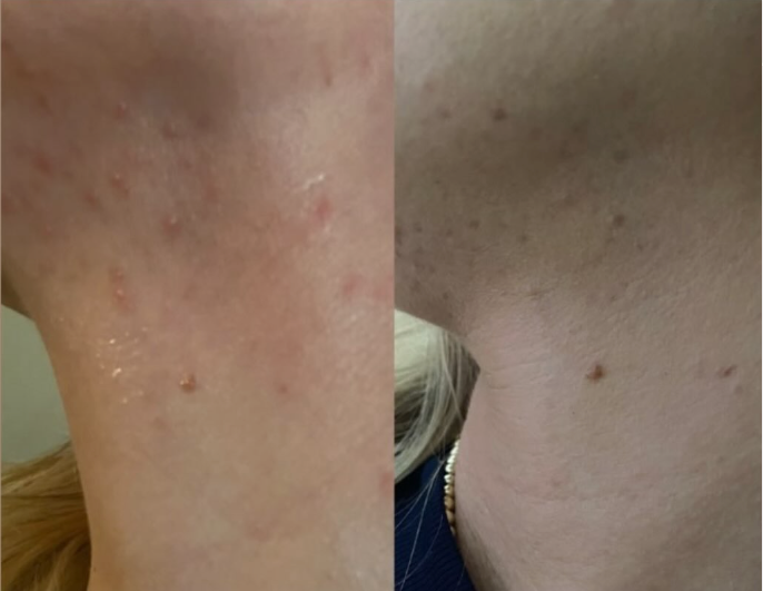 Why Your Skin Barrier Matters and How to Fix It Naturally